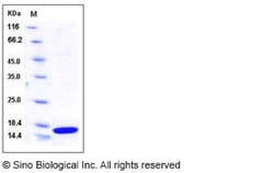 Sino Biological Recombinant Human FABP2 Protein (His Tag), HPLC-verified,