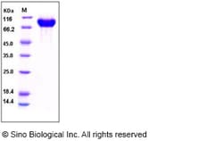 Sino Biological Recombinant Human pIgR Protein (365 Ser/Gly, His Tag),