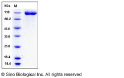 Sino Biological Human VEGFR1 / FLT-1 Protein (His Tag) 100ug, Quantity: