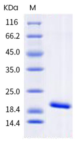 Sino Biological Recombinant Human IL-1 beta Protein, HPLC-verified, Quantity: