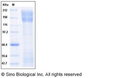 Sino Biological Recombinant Human L1CAM Protein (His Tag), HPLC-verified,