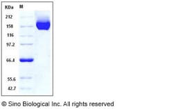 Sino Biological Recombinant Human CHL-1/L1CAM-2 Protein (His Tag), HPLC-verified,
