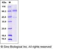 Sino Biological Recombinant Human TLR4 Protein (ECD, His Tag), Quantity:
