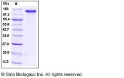 Sino Biological Human CD31 / PECAM1 Protein (Fc Tag) 100ug, Quantity: Each