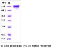 Sino Biological Recombinant Human Complement C2 Protein (hFc Tag), Quantity: