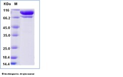 Sino Biological Recombinant Human Complement C2 Protein (His Tag), Quantity:
