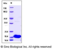 Sino Biological Recombinant Human IL-37 Protein, HPLC-verified, Quantity: