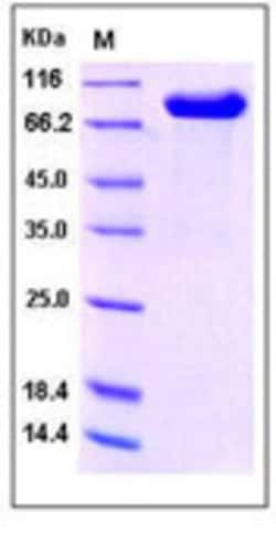 Sino Biological Recombinant Human IL1RAPL2 Protein (hFc Tag), Quantity:
