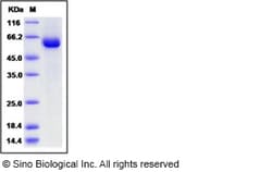 Sino Biological Recombinant Human tPA Protein (hFc Tag), Quantity: Each