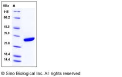 Sino Biological Recombinant Human Factor D Protein (His Tag), HPLC-verified,