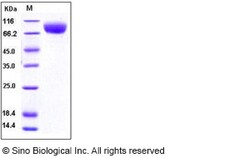 Sino Biological Recombinant Human M-CSFR/CSF1R Protein (ECD, His Tag),