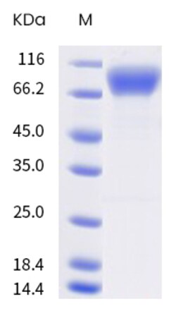 Sino Biological Human CSF1R Protein 20ug (Sino Biological), Quantity: Each