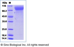 Sino Biological Recombinant Human M-CSFR/CSF1R Protein, HPLC-verified,