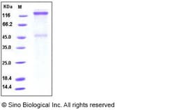 Sino Biological Human IGF1R / CD221 Protein (His Tag) 100ug, Quantity: