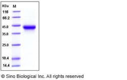 Sino Biological Recombinant Human CD25/IL-2R alpha Protein (ECD, His Tag),