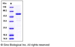 Sino Biological Recombinant Human CNDP2 Protein (His Tag), Quantity: Each