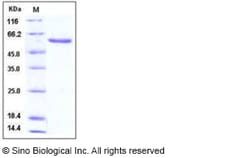 Sino Biological Human NBL1 / DAND1 / DAN Protein (Fc Tag) 100ug, Quantity: