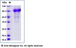 Sino Biological Recombinant Human DKK-1 Protein (hFc Tag) 1 mg, Quantity: