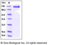 Sino Biological Recombinant Human DLL4 Protein (ECD, hFc Tag), HPLC-verified,