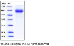 Sino Biological Recombinant Human DLL4 Protein (His Tag), HPLC-verified