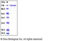 Sino Biological Human COMP Protein (His Tag) 100ug, Quantity: Each of 1