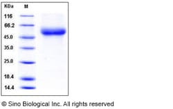 Sino Biological Human IL18RAP / IL1R7 Protein (His Tag) 1mg, Quantity: