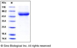Sino Biological Human IL18RAP / IL1R7 Protein (His Tag) 100ug, Quantity: