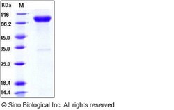 Sino Biological Recombinant Human IL1RAPL1 Protein (hFc Tag), Quantity: