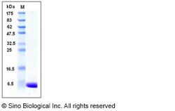 Sino Biological Recombinant Human S100A1 Protein, Quantity: Each of 1