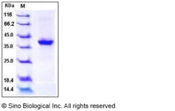Sino Biological Recombinant Human S100A2 Protein (hFc Tag), Quantity: Each