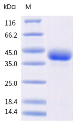 Sino Biological&nbsp;Recombinant Human S100B Protein (hFc Tag), Biotinylated, HPLC-verified 100 µg