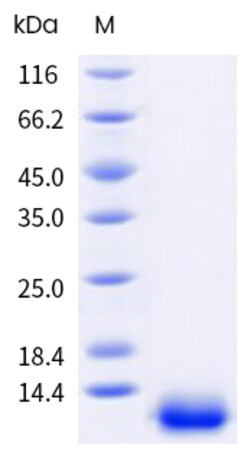 Sino Biological&nbsp;Recombinant Human S100B Protein (His Tag), Biotinylated, HPLC-verified 100 µg