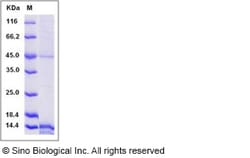 Sino Biological Recombinant Human Prokineticin 1/EG-VEGF Protein (His Tag),