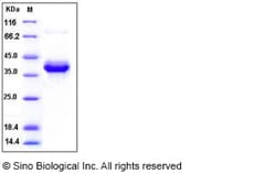 Sino Biological Recombinant Human S100A4 Protein (hFc Tag), Quantity: Each
