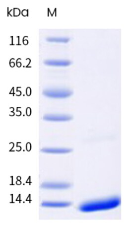 Sino Biological&nbsp;Recombinant Human S100A4 Protein (His Tag), Biotinylated 100 µg