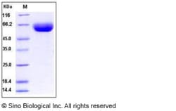 Sino Biological Recombinant Human CD147/Basigin/EMMPRIN Protein (hFc Tag),