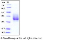 Sino Biological Recombinant Human CD147/Basigin/EMMPRIN Protein (His Tag),
