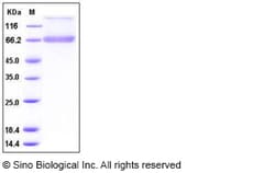 Sino Biological Recombinant Human Decorin Protein (hFc Tag), Quantity: