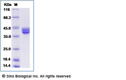 Sino Biological Recombinant Human Decorin Protein, Quantity: Each of 1