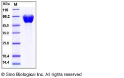Sino Biological Recombinant Human Ephrin A5 Protein (hFc Tag), Quantity: