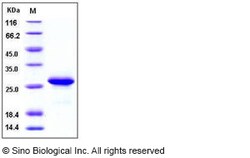Sino Biological Recombinant Human Ephrin A5 Protein (His Tag), Quantity: