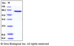 Sino Biological Recombinant Human JAM-A/F11 Receptor Protein (hFc Tag),