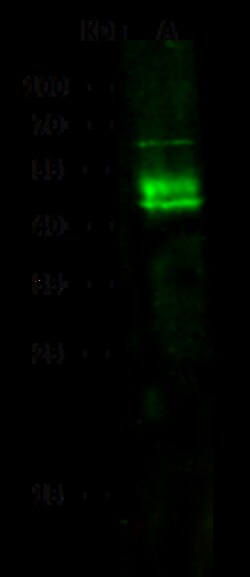 Sino Biological Recombinant Anti-DC-SIGN/CD209 Antibody, Rabbit Monoclonal,