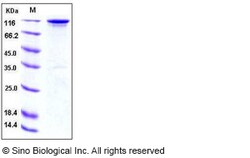 Sino Biological Recombinant Human HER3/ERBB3 Protein (ECD, hFc Tag), HPLC-verified,