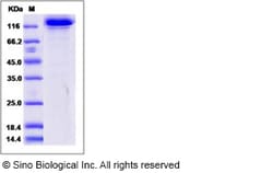 Sino Biological Recombinant Human HER3/ERBB3 Protein (mFc Tag) 1 mg, Quantity: