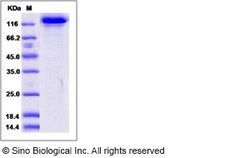 Sino Biological Recombinant Human HER3/ERBB3 Protein (mFc Tag), Quantity: