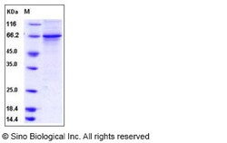Sino Biological Human HER3 / ErbB3 Protein (aa 730-1065, His & GST Tag)