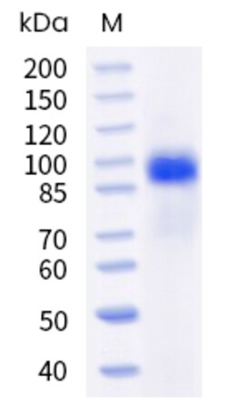 Sino Biological Human ERBB3 Protein 20ug (Sino Biological), Quantity: Each