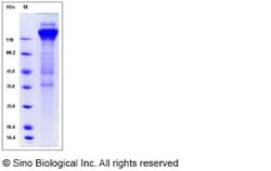 Sino Biological Human cytomegalovirus (HCMV) Glycoprotein B / gB Protein