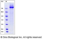Sino Biological Human cytomegalovirus (HCMV) Glycoprotein B / gB Protein